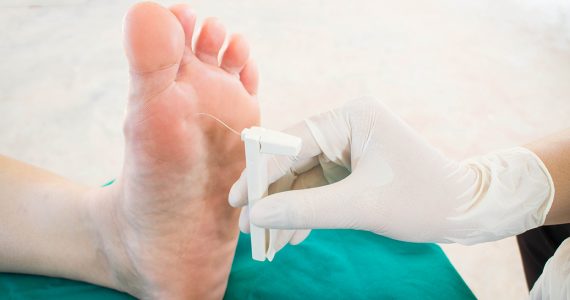 Traitement et prévention du pied diabétique