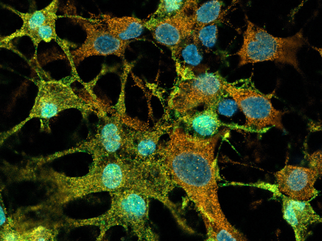 Excellence in Neuroinflammation Award: Candidature APERTE!